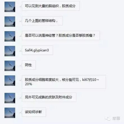 卵巢畸胎瘤，成熟或未成熟性？（曾丽霞分享病例，孔祥田(Max)*Roswell*NM老师讲解）