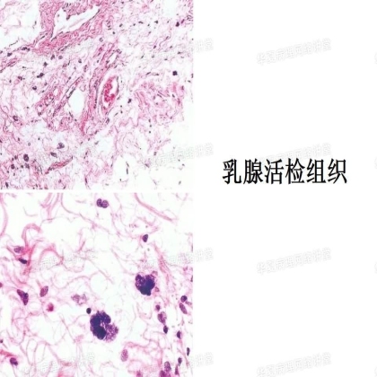 华夏病理网“在线课堂”学习有感