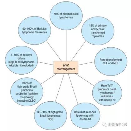 侵袭性B细胞淋巴瘤——GZL(2)