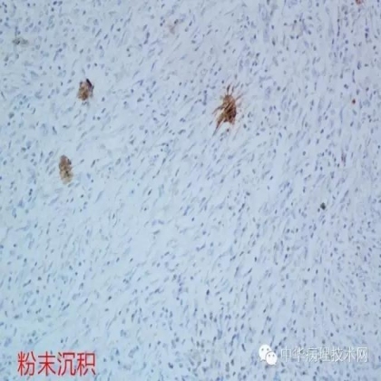 免疫组化结果的分析和常见问题的处理