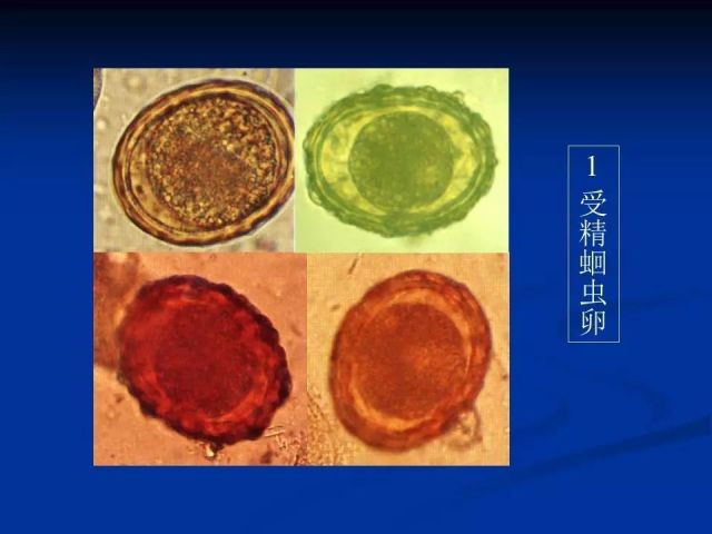 收藏！寄生虫图谱大全