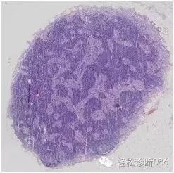 淋巴结T区和髓质组织学