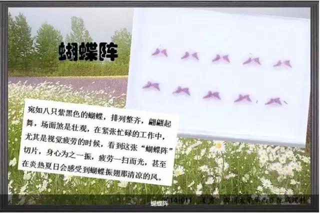 你见过这么美的病理切片吗？