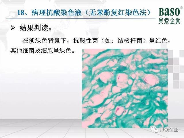 收藏:最全病理染色原理、染色流程、注意事项分享 收藏:最全病理染色原理、染色流程、注意事项分享