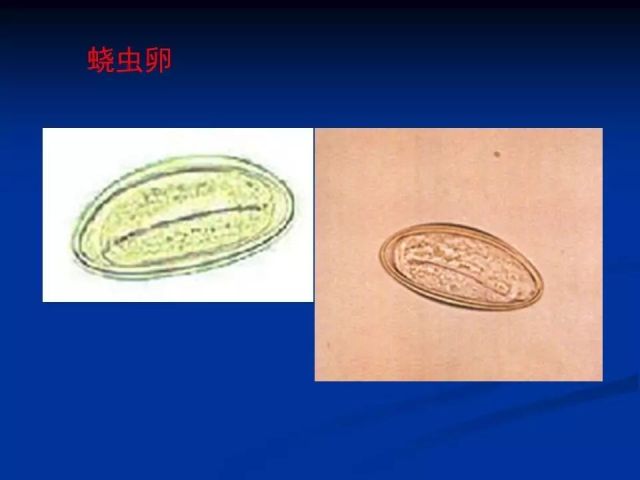 收藏！寄生虫图谱大全