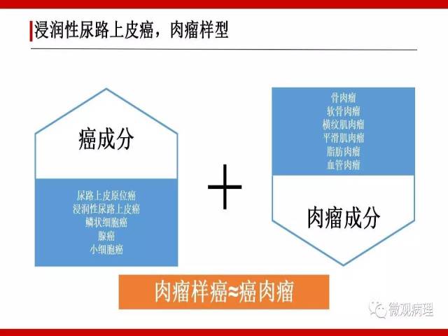 泌尿课程/浸润性尿路上皮癌病理学类型