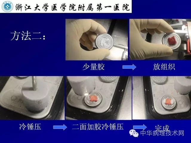 冰冻切片报告注意事项