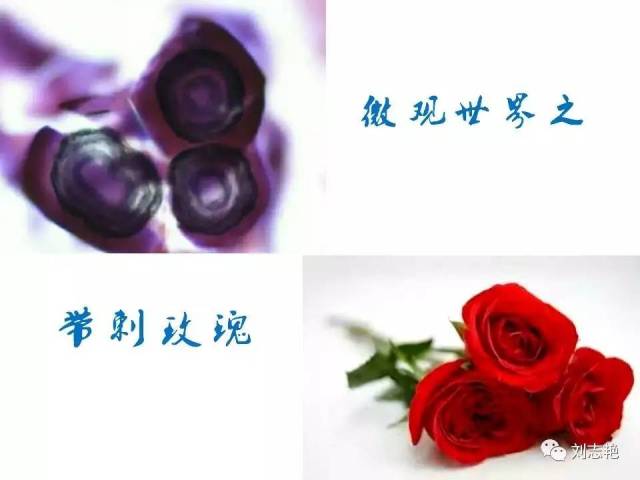 另类甲状腺FNA细胞学