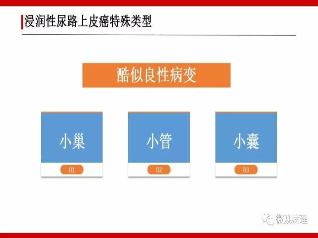 泌尿课程/浸润性尿路上皮癌病理学类型
