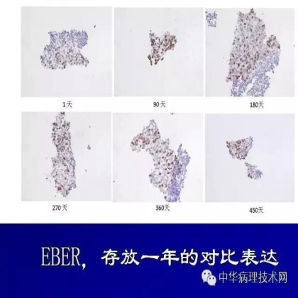 免疫组化液态阳性对照