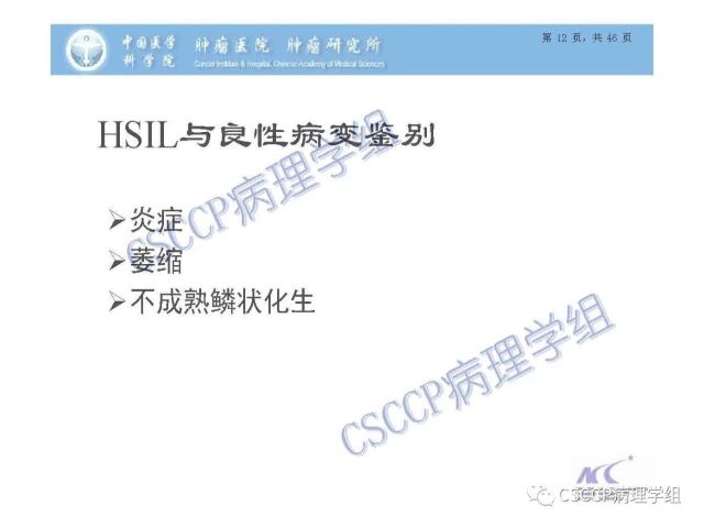 宫颈癌前病变中的诊断难点及阴道镜中ECC的 应用价值