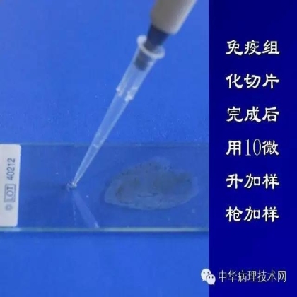 免疫组化液态阳性对照