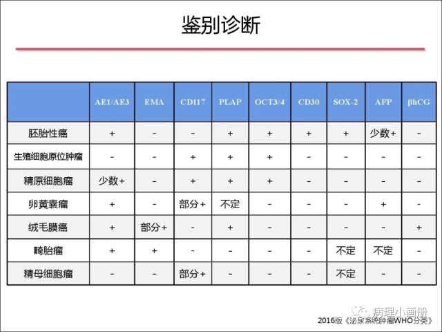 泌尿病理--精原细胞瘤VS精母细胞瘤