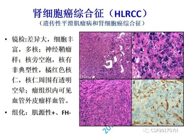 病理临床结合 开拓诊断视野