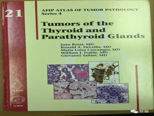 甲状腺乳头状癌伴喉返神经旁淋巴结中见小块分化好的甲状腺组织，转移癌？（阿姚分享，孔祥田(Max)*Roswell*NM老师讲解）