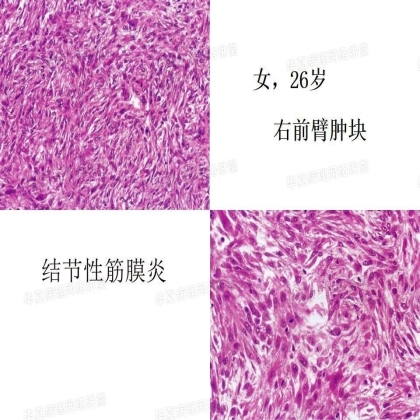 华夏病理网“在线课堂”学习有感