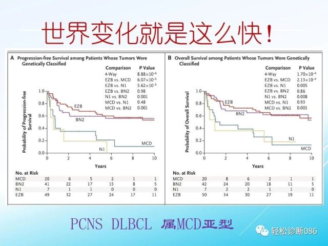 中枢神经系统弥漫大B细胞淋巴瘤