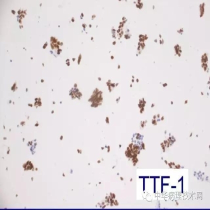 免疫组化液态阳性对照