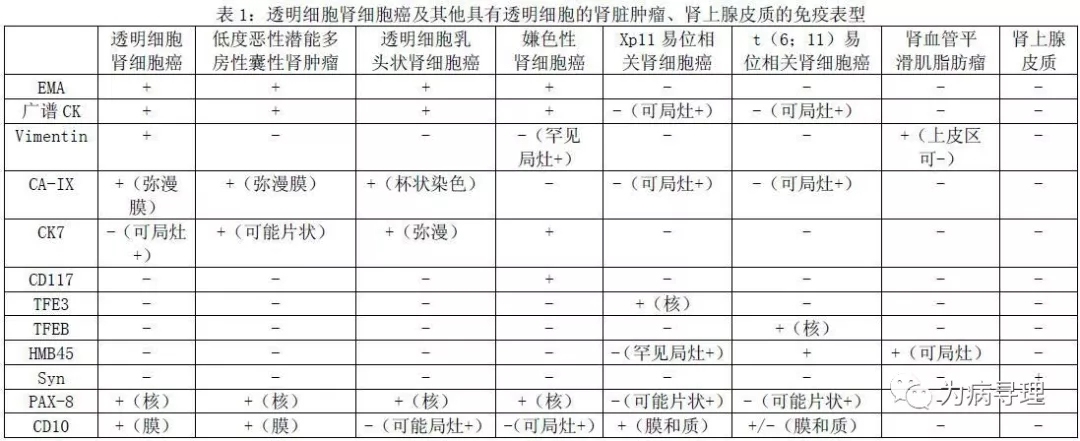 透明细胞乳头状肾细胞癌