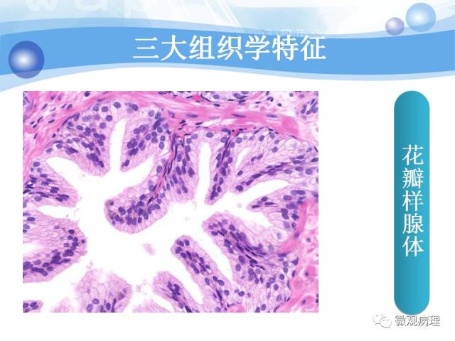 正常前列腺组织学