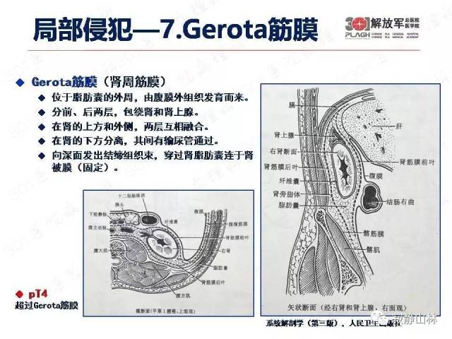 泌尿系统常见肿瘤标本病理报告规范