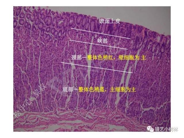 上消化道早癌病理的学习心得体会（附胃牵手癌的病例特点文献学习）