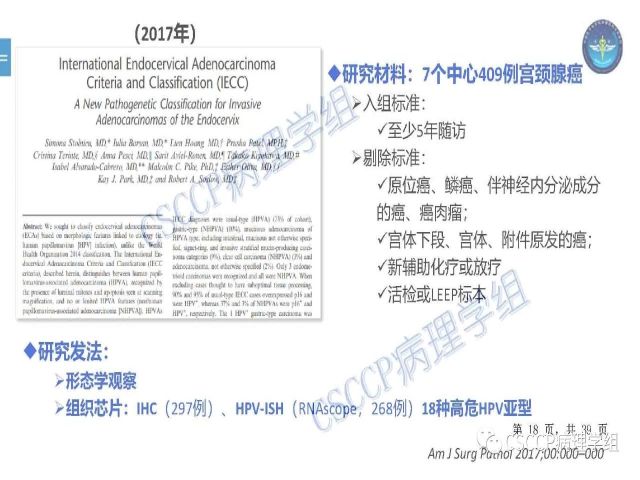 黄文亭 张询：宫颈腺癌分类介绍