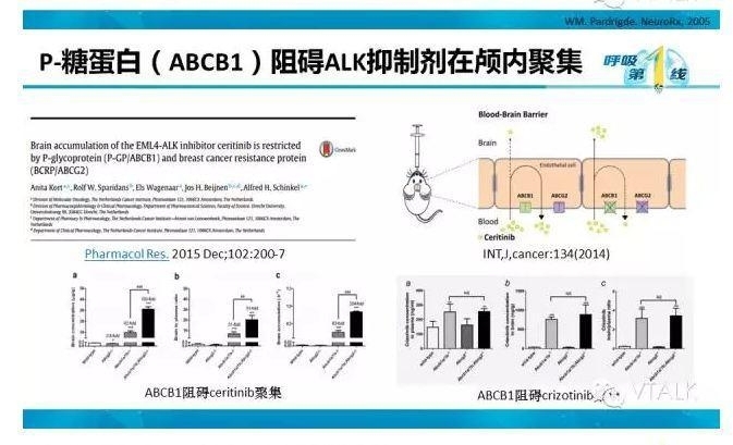 驱动基因阳性NSCLC脑转移：阿克琉斯之踵？