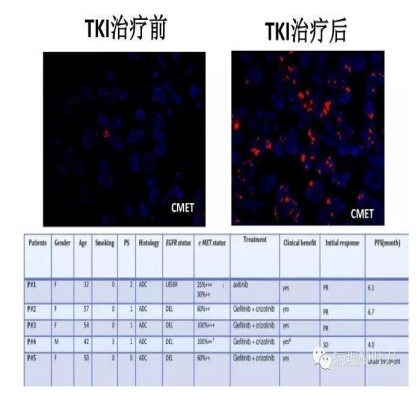 肿瘤精确医疗与分子病理检测