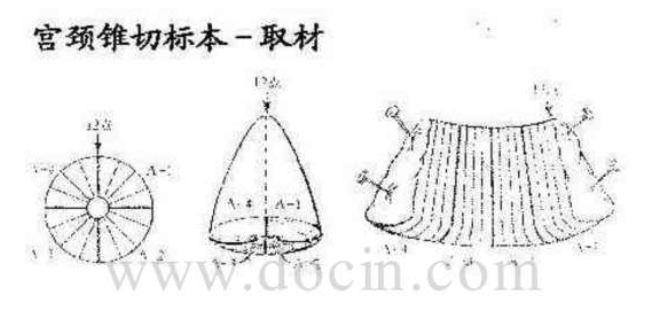 病理标本取材规范
