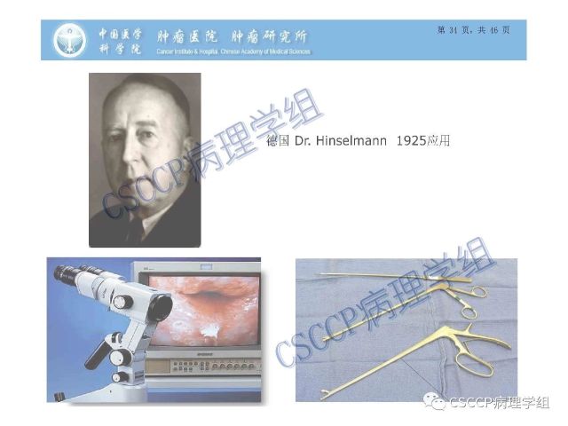 宫颈癌前病变中的诊断难点及阴道镜中ECC的 应用价值