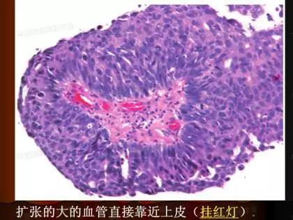 学习《病理诊断的关键点》：病理诊断中的“充分与必要”条件