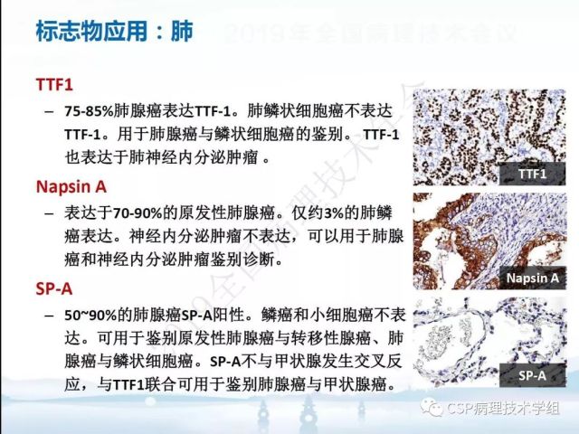 免疫组化检测的临床应用与质量评估