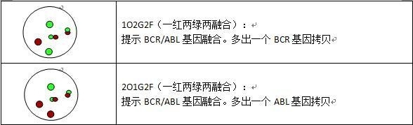 血液肿瘤FISH检测判读建议(一): 基因融合