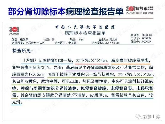 泌尿系统常见肿瘤标本病理报告规范