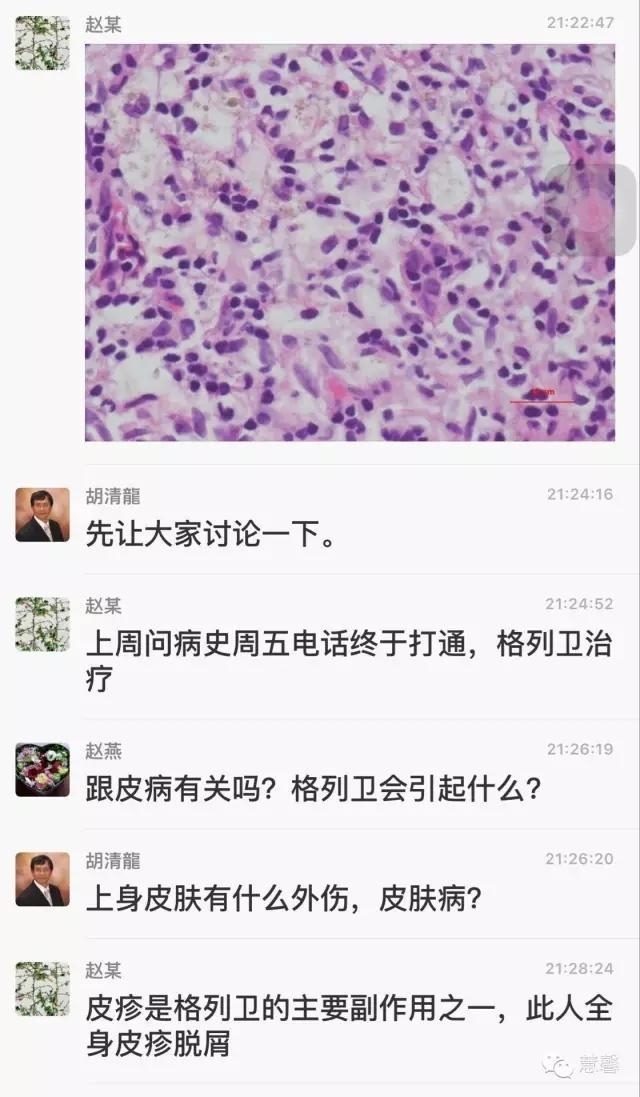 皮病性淋巴结炎，与格列卫治疗相关？（赵洋病例分享，华夏病理学术二群讨论）