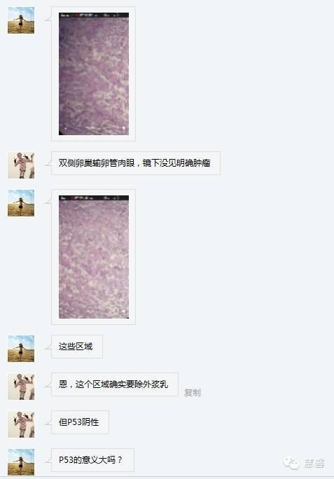 乳头状汗管囊腺瘤诊断及取材相关问题（迟悟分享，孔祥田及于励民老师讲解）