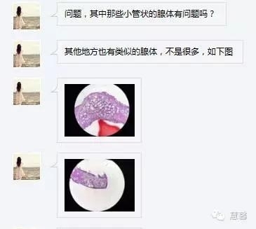 前列腺腺癌？（芳分享病例，华夏泌尿群讨论，孔祥田老师讲解）