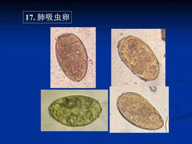 收藏！寄生虫图谱大全