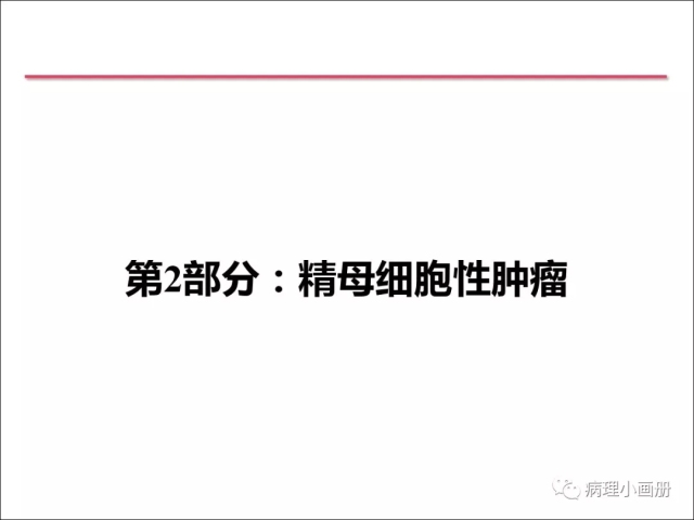 泌尿病理--精原细胞瘤VS精母细胞瘤