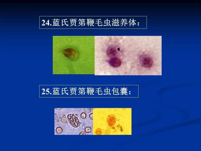收藏！寄生虫图谱大全