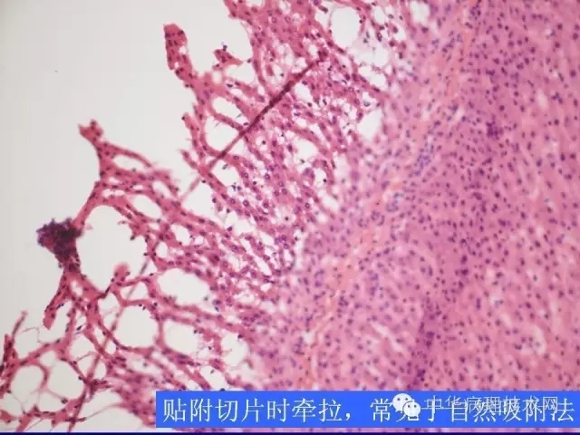 冰冻切片报告注意事项