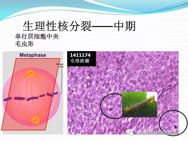 病理学基础知识 : 核分裂像的识别