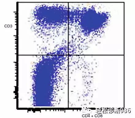 免疫缺陷相关性淋巴组织增殖性疾病（2）