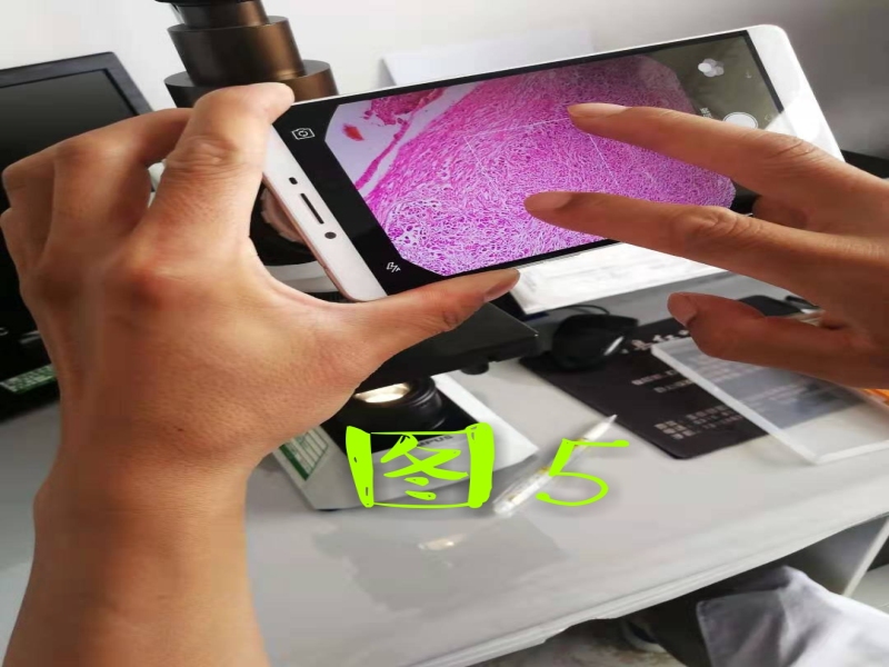 病理科工作札记（三十六）如何用手机拍出满意的组织学照片