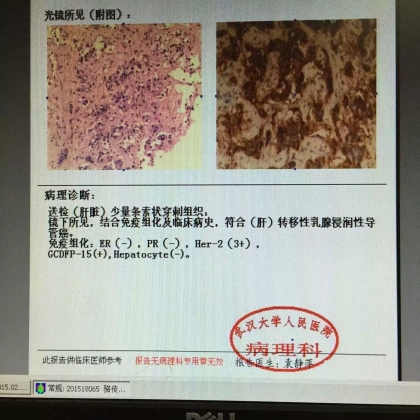 病理科新技术（二）：穿刺组织学明确诊断