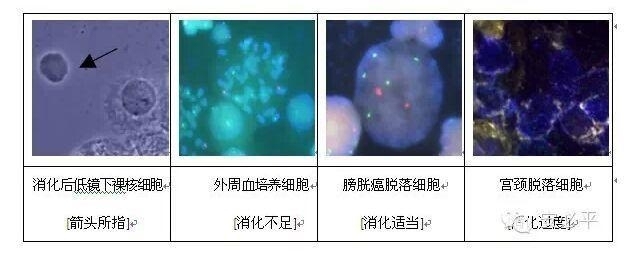 荧光原位杂交(FISH)样本处理标准方案系列(二)——常规细胞学样本