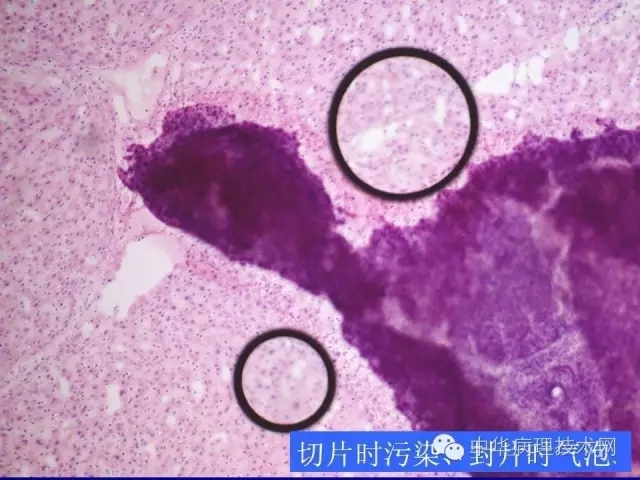 冰冻切片报告注意事项