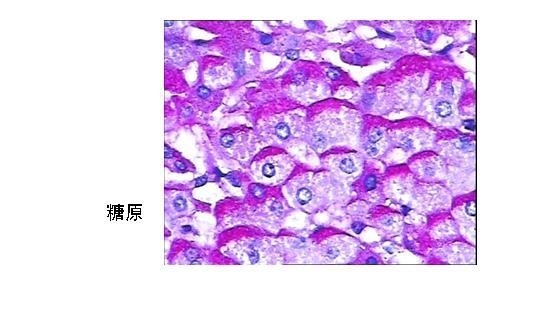 特殊染色室内质量控制