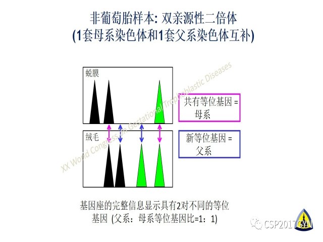 p57免疫组化染色及基因分型 在葡萄胎精确诊断中的应用